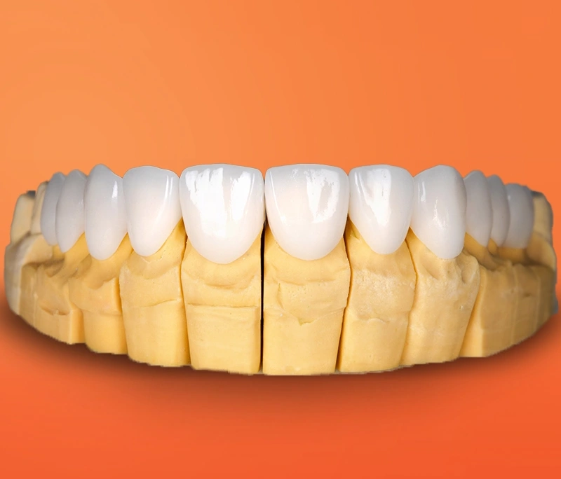 TOP 3+ răng sứ Đức được yêu thích nhất 2025: So sánh & bảng giá